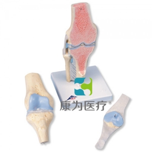 膝關節(jié)截面模型，3部分
