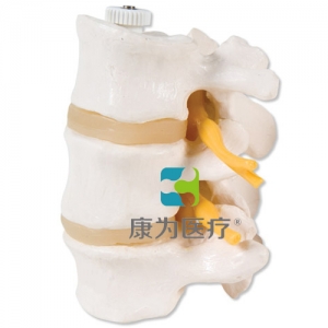 活動安裝3塊腰椎